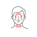 Rosacea - Package of 3