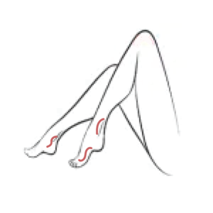 VL-FV - Ankles & Feet Veins- Single Session (Copy)