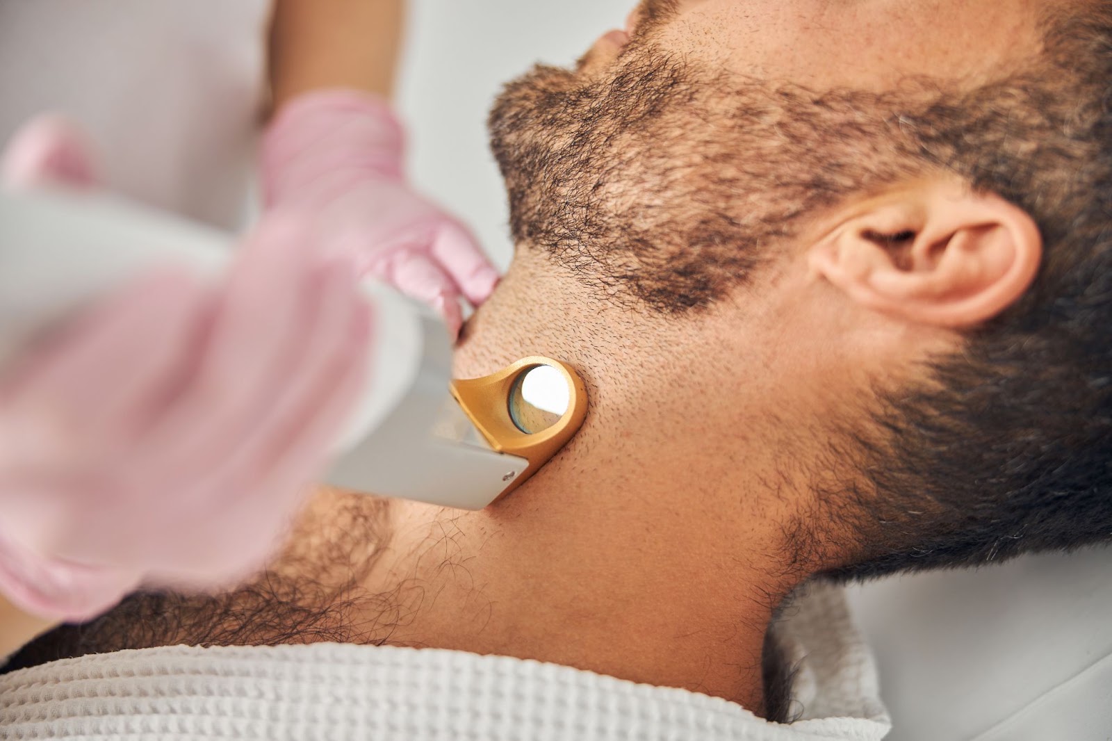 5 Common Myths About Laser Hair Removal 1 Image of a male having laser hair removal for beard