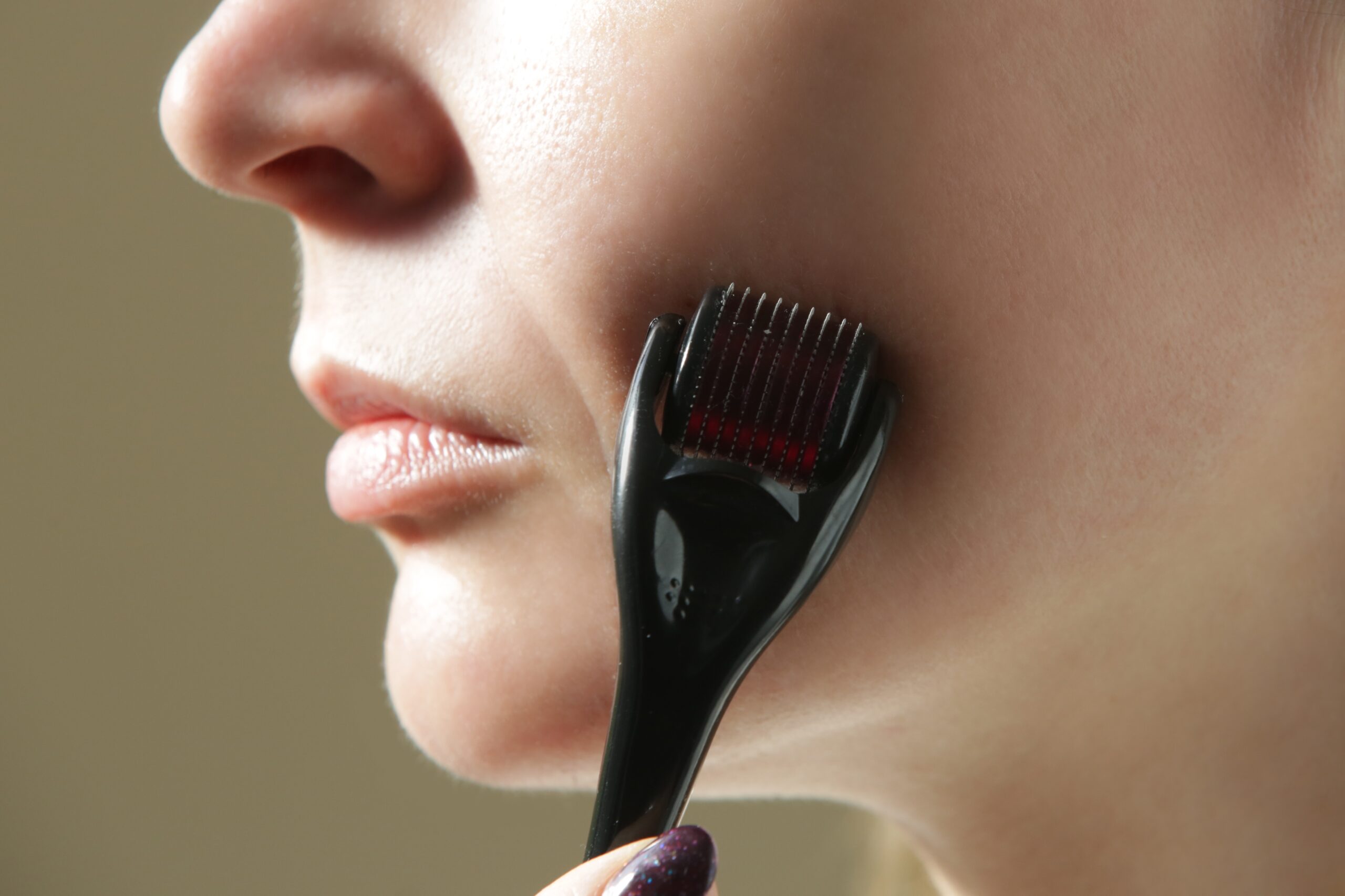 derma roller on persons cheek