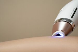 How Much Does Laser Hair Removal Treatment Cost in Toronto?