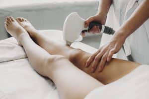 Woman getting mircroneedling treatment on legs