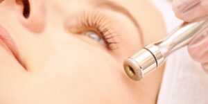 How Does Microdermabrasion Work?