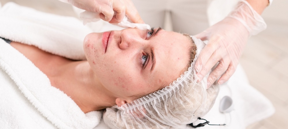 No, you don't need to use disposable face towels to prevent acne breakouts  - Yahoo Sports