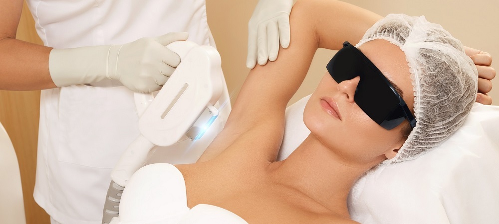 laser hair removal
