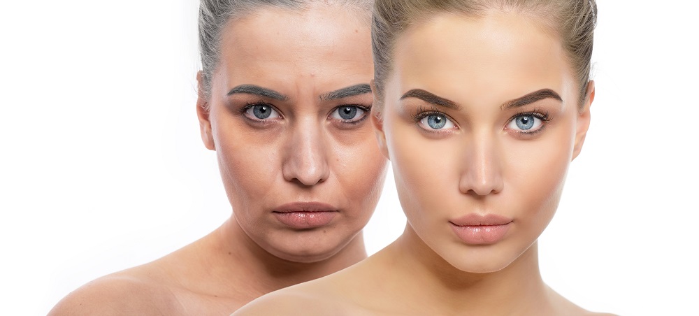 How to Treat Under-Eye Bags - Miami Skin & Vein