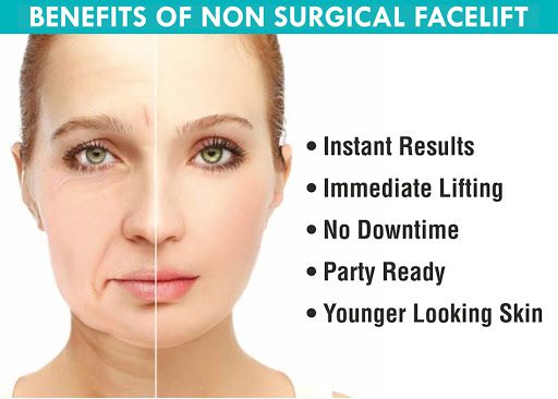 Non surgical face lift in Toronto & Mississauga