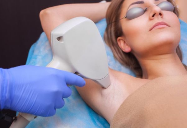  Laser Hair Removal 