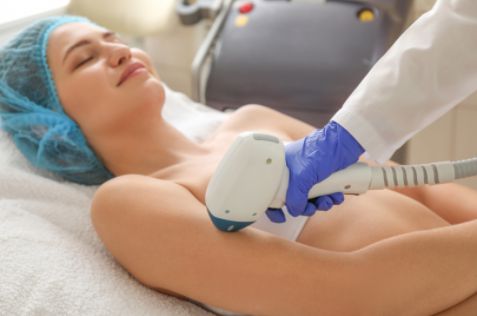  Laser Hair Removal 