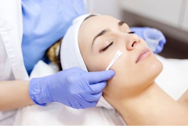 chemical peel