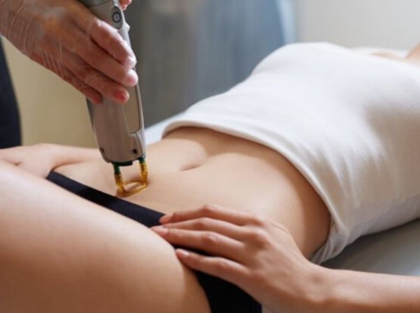  Laser Hair Removal 
