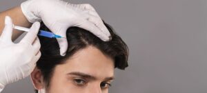 how does prp help you recover lost hair