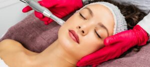 how much does microneedling cost in toronto