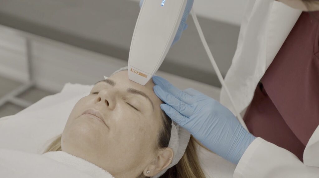 Fractional CO2 Laser in Toronto