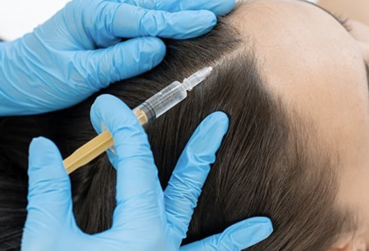What is PRP?