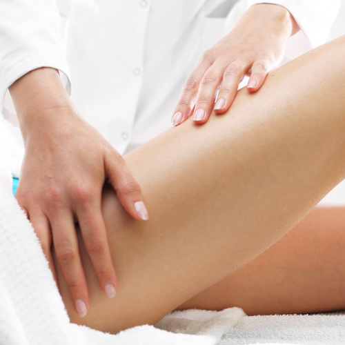Cellulite - PrepPost