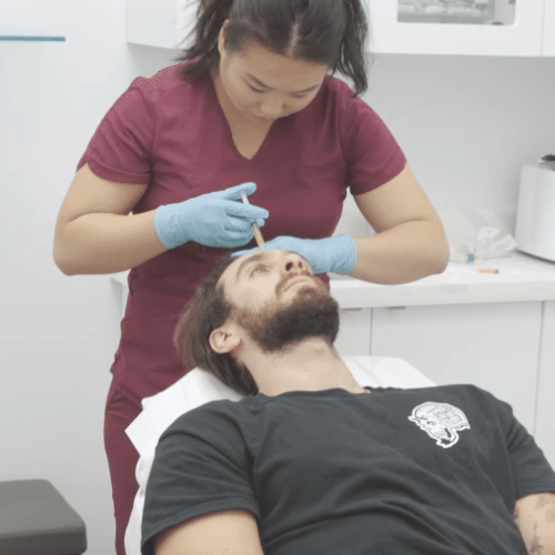 PRP hair loss treatment at Canada Medlaser clinic