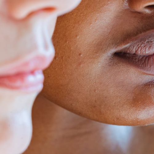 Canada Medlaser offers treatments for any skin concerns