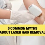 Cover photo for 5 common myths of laser hair removal blog