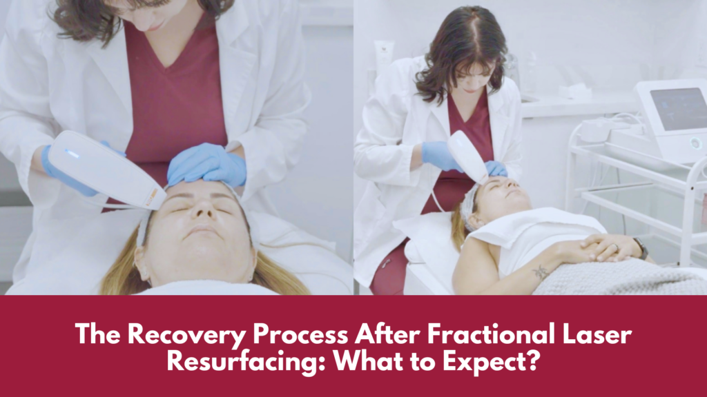 The Recovery Process After Fractional Laser Resurfacing: What to Expect? Blog cover photo