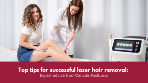 Top tips for successful laser hair removal: Expert advice from Canada Med Laser Cover