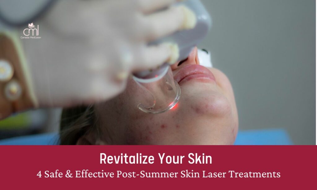 evitalize Your Skin 4 Safe & Effective Post-Summer Skin Laser Treatments