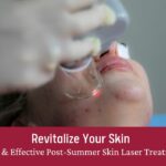 evitalize Your Skin 4 Safe & Effective Post-Summer Skin Laser Treatments