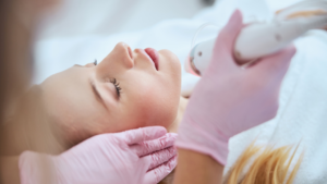 This is a microneedling blog image