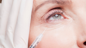 This is a botox injection treatment blog image