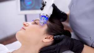 This is a Microneedling blog image