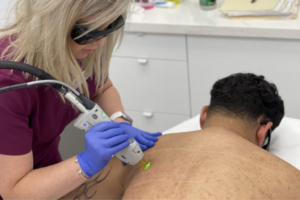 Preparing for Your First Full Body Laser Hair Removal Session Blog featured image