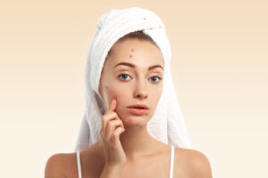 Acne and Skin Treatment blogs