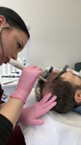 Hair Restoration Exosome Therapy