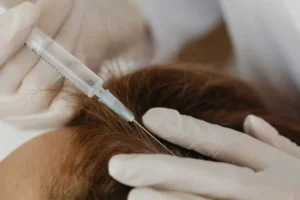 Exosome Hair treatment- needle