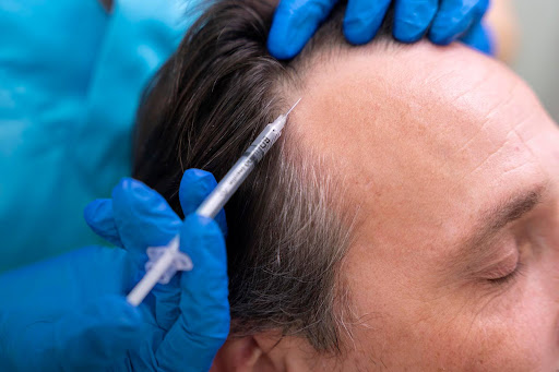 Exosome Treatment for Hair