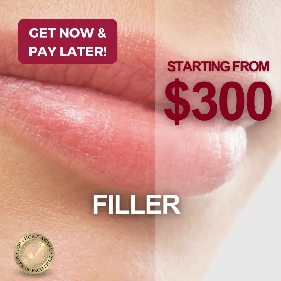 Filler June Promotion