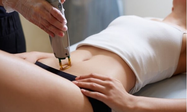Laser hair removal machine being used on woman's belly