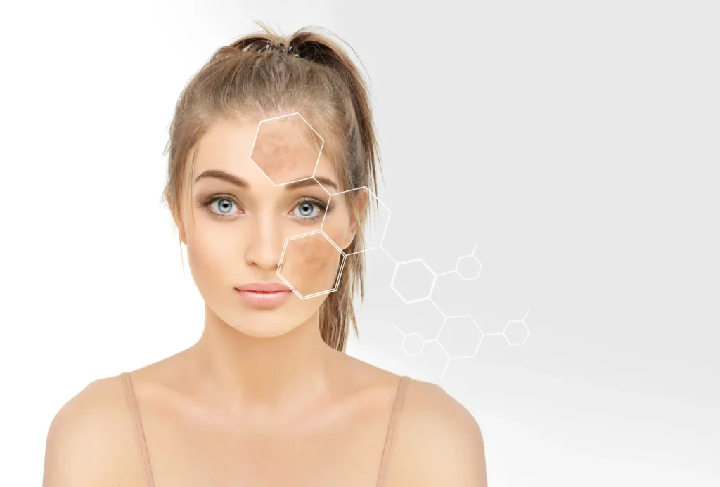 Woman with zoomed in graphic of chemical peel