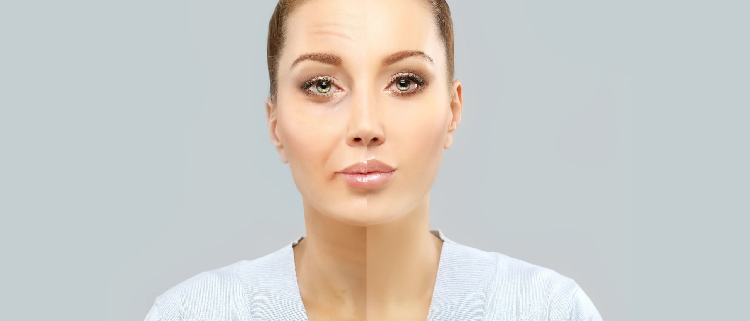 Before and after of woman with botox injections
