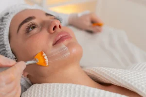 Chemical peel applied to clients face