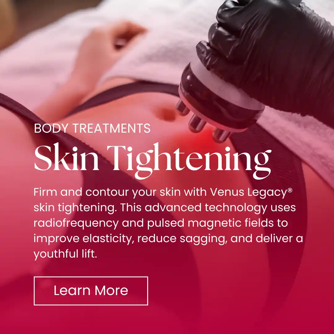 Body - Skin Tightening