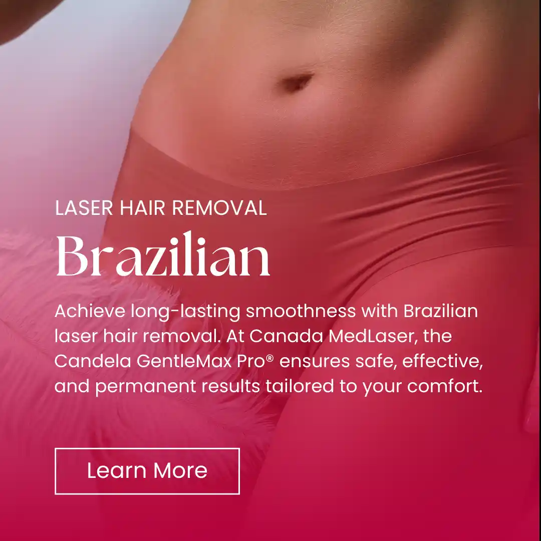 Hair Removal - Brazilian