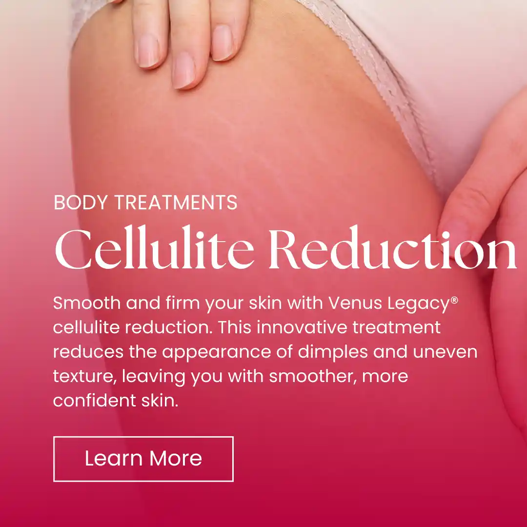 Body - Cellulite Reduction Banner