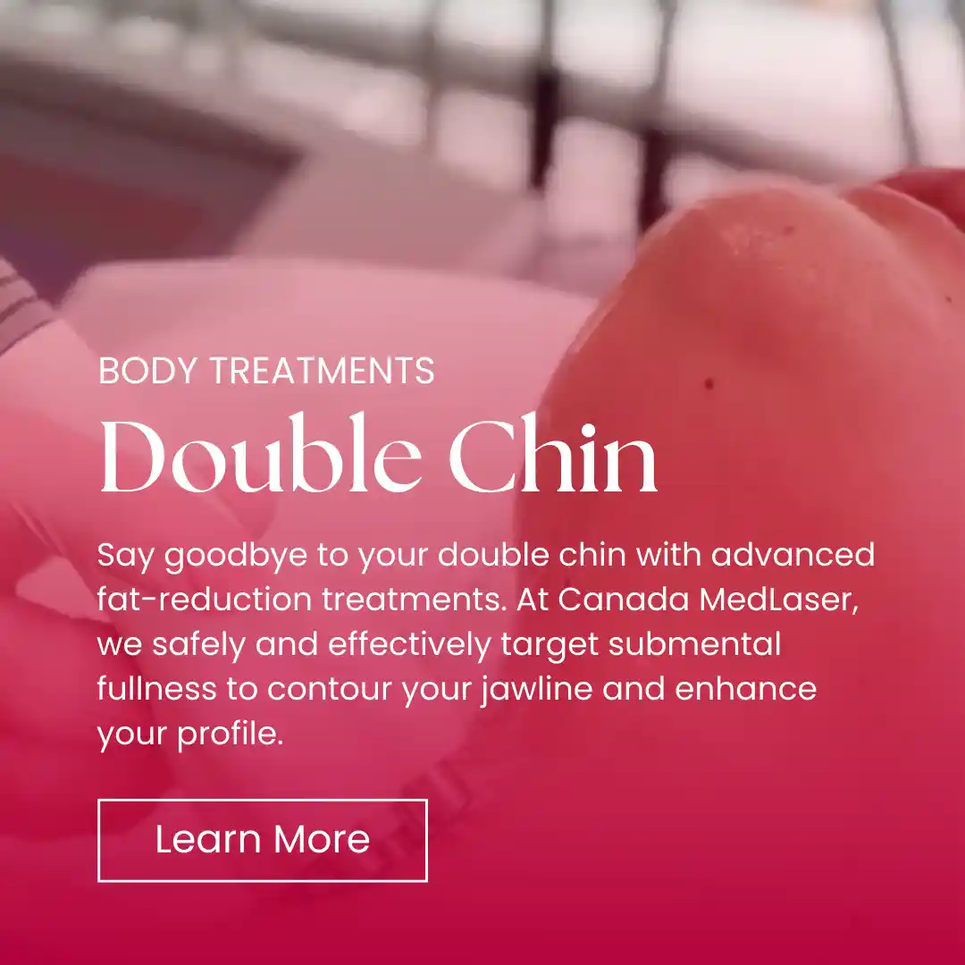 Body - Double Chin Removal