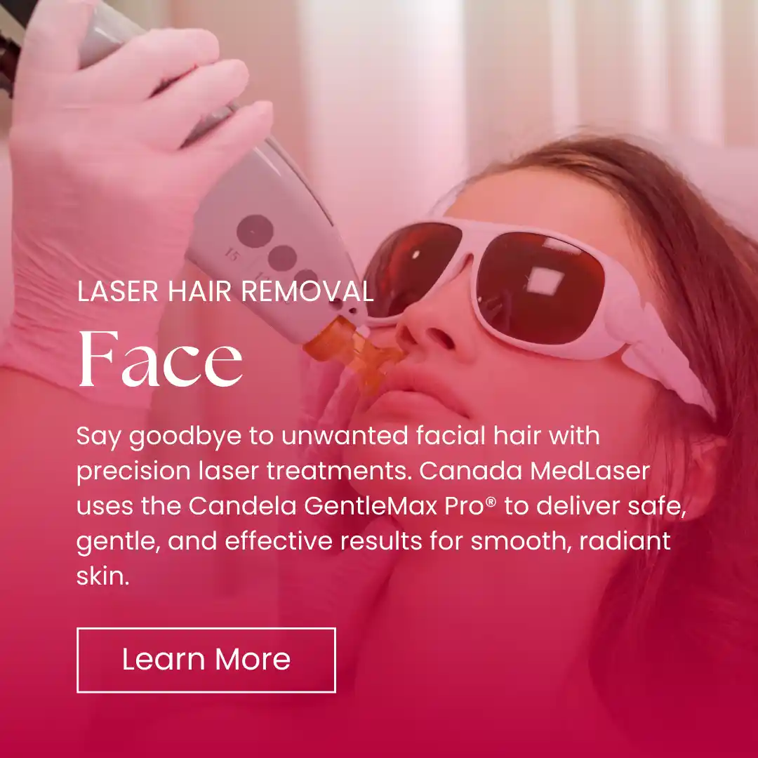 Hair Removal - Face