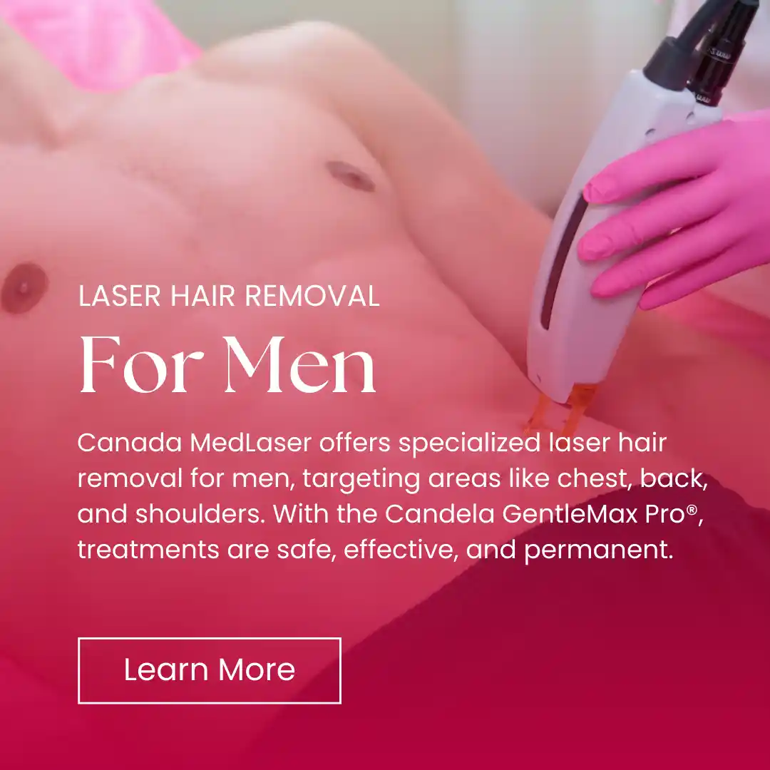 Hair Removal - For Men