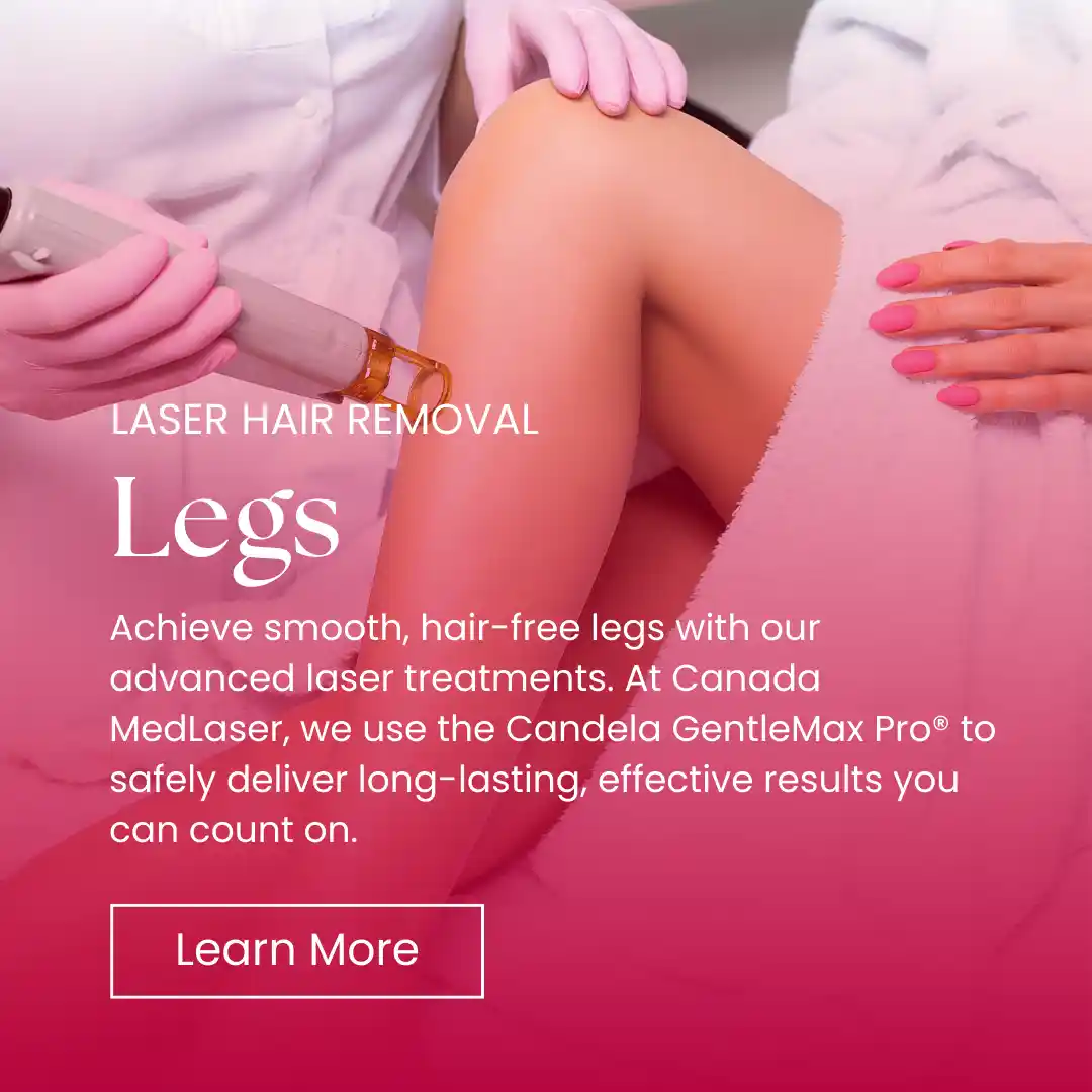 Hair Removal - Legs