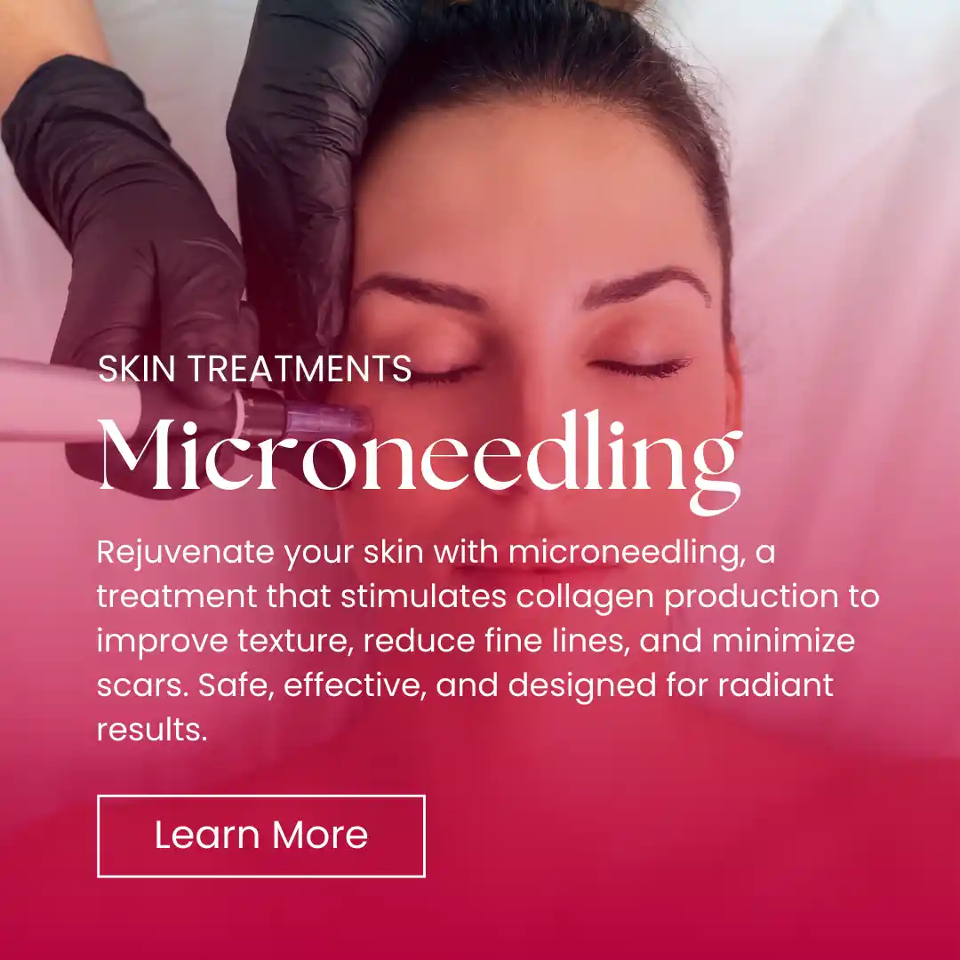 Skin - Microneedling Banner