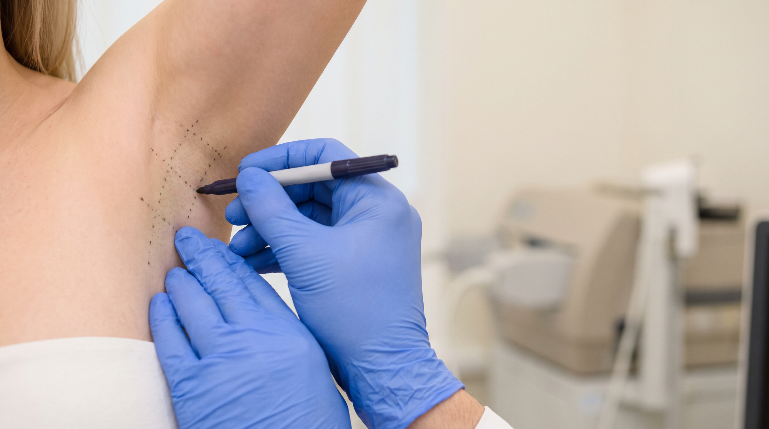 Gloved clinician marking a small grid on a patient's underarm to map sweat glands before Botox injections