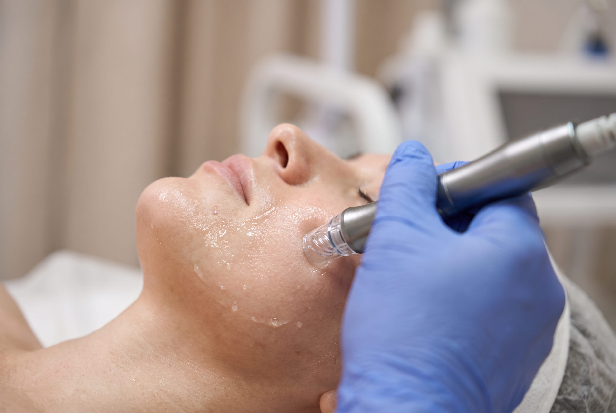 HydraFacial Benefits: What It Does for Your Skin, Cost, and What to Expect 1 Close-up of a HydraFacial-style handpiece with a spiral tip gliding over smooth hydrated cheek skin